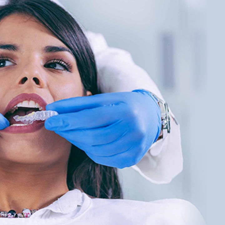 How to find a great orthodontist in San Francisco (and in US in general)